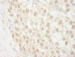 MTA3 Antibody in Immunohistochemistry (IHC)