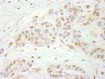 MTA3 Antibody in Immunohistochemistry (IHC)