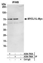 MYCL1/L-Myc Antibody in Immunoprecipitation (IP)