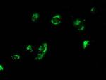 MYD88 Antibody in Immunocytochemistry (ICC/IF)