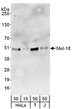 Mel-18 Antibody in Western Blot (WB)