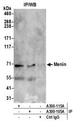 Menin Antibody in Western Blot (WB)