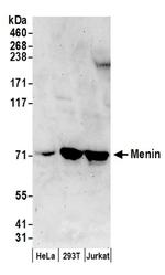 Menin Antibody in Western Blot (WB)