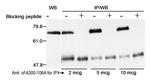 Menin Antibody in Western Blot (WB)