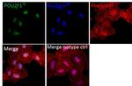 Mouse IgG (H+L) Highly Cross-Adsorbed Secondary Antibody in Immunocytochemistry (ICC/IF)