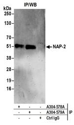 NAP-2 Antibody in Immunoprecipitation (IP)