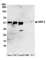 NAP-2 Antibody in Western Blot (WB)