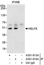 NELFE Antibody in Immunoprecipitation (IP)