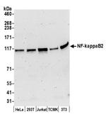 NF-kappaB2 Antibody in Western Blot (WB)