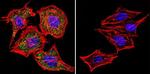 NFATC1 Antibody in Immunocytochemistry (ICC/IF)