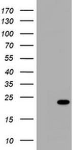 NME1 Antibody in Western Blot (WB)