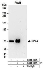 NPL4 Antibody in Immunoprecipitation (IP)
