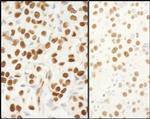 NPM1 Antibody in Immunohistochemistry (IHC)