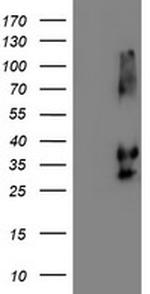 NPTN Antibody in Western Blot (WB)