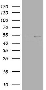 NR2C1 Antibody in Western Blot (WB)