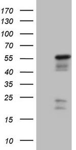 NR2E3 Antibody in Western Blot (WB)