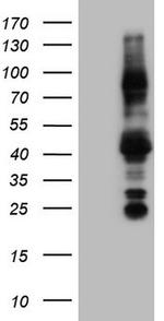 NR3C1 Antibody in Western Blot (WB)