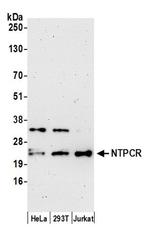 NTPCR Antibody in Western Blot (WB)