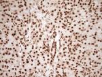 NUDT21 Antibody in Immunohistochemistry (Paraffin) (IHC (P))