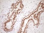 NUDT21 Antibody in Immunohistochemistry (Paraffin) (IHC (P))