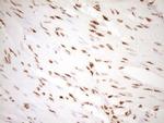 NUDT21 Antibody in Immunohistochemistry (Paraffin) (IHC (P))