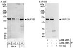 NUP133 Antibody in Western Blot (WB)