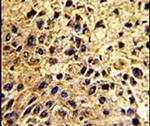 NUP62 Antibody in Immunohistochemistry (IHC)