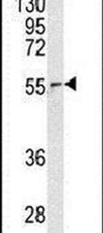 NUP62 Antibody in Western Blot (WB)