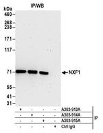 NXF1 Antibody in Western Blot (WB)