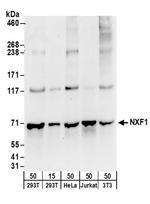 NXF1 Antibody in Western Blot (WB)