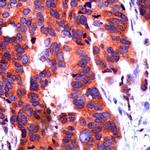 NOTCH1 Antibody in Immunohistochemistry (IHC)