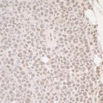 OCT1 Antibody in Immunohistochemistry (IHC)