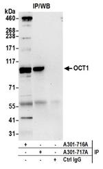 OCT1 Antibody in Immunoprecipitation (IP)