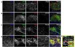 OLIG2 Antibody in Immunohistochemistry (IHC)