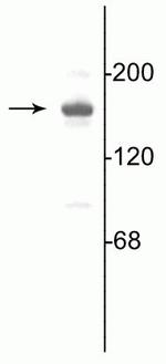 NMDAR2A Antibody in Western Blot (WB)