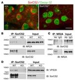 NMDAR2A Antibody in Immunoprecipitation (IP)