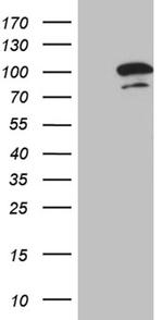 OTUD7B Antibody in Western Blot (WB)