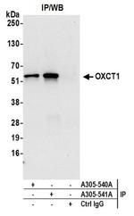 OXCT1 Antibody in Western Blot (WB)