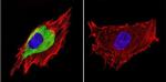 Caveolin 3 Antibody in Immunocytochemistry (ICC/IF)