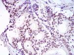 53BP1 Antibody in Immunohistochemistry (Paraffin) (IHC (P))