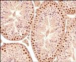 SCP3 Antibody in Immunohistochemistry (Paraffin) (IHC (P))