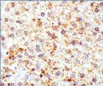 ADFP Antibody in Immunohistochemistry (Paraffin) (IHC (P))