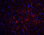 GFR alpha-1 Antibody in Immunohistochemistry (Paraffin) (IHC (P))