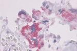 PTH1R Antibody in Immunohistochemistry (Paraffin) (IHC (P))