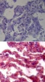 TLR7 Antibody in Immunohistochemistry (Paraffin) (IHC (P))