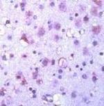 GSK3 alpha/beta Antibody in Immunohistochemistry (IHC)