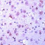 GSK3 alpha/beta Antibody in Immunohistochemistry (IHC)