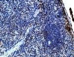 IL-21 Antibody in Immunohistochemistry (IHC)