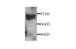 MMP9 Antibody in Western Blot (WB)