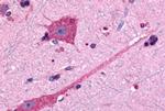 DRD2 Antibody in Immunohistochemistry (Paraffin) (IHC (P))